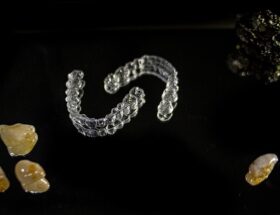 Sådan foregår en invisalign-behandling – trin for trin